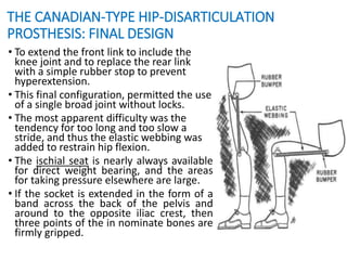 THE CANADIAN-TYPE HIP-DISARTICULATION
PROSTHESIS: FINAL DESIGN
• To extend the front link to include the
knee joint and to replace the rear link
with a simple rubber stop to prevent
hyperextension.
• This final configuration, permitted the use
of a single broad joint without locks.
• The most apparent difficulty was the
tendency for too long and too slow a
stride, and thus the elastic webbing was
added to restrain hip flexion.
• The ischial seat is nearly always available
for direct weight bearing, and the areas
for taking pressure elsewhere are large.
• If the socket is extended in the form of a
band across the back of the pelvis and
around to the opposite iliac crest, then
three points of the in nominate bones are
firmly gripped.
 