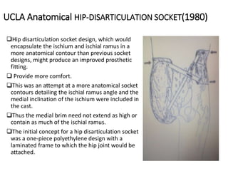 UCLA Anatomical HIP-DISARTICULATION SOCKET(1980)
Hip disarticulation socket design, which would
encapsulate the ischium and ischial ramus in a
more anatomical contour than previous socket
designs, might produce an improved prosthetic
fitting.
 Provide more comfort.
This was an attempt at a more anatomical socket
contours detailing the ischial ramus angle and the
medial inclination of the ischium were included in
the cast.
Thus the medial brim need not extend as high or
contain as much of the ischial ramus.
The initial concept for a hip disarticulation socket
was a one-piece polyethylene design with a
laminated frame to which the hip joint would be
attached.
 