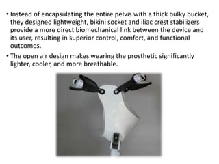 • Instead of encapsulating the entire pelvis with a thick bulky bucket,
they designed lightweight, bikini socket and iliac crest stabilizers
provide a more direct biomechanical link between the device and
its user, resulting in superior control, comfort, and functional
outcomes.
• The open air design makes wearing the prosthetic significantly
lighter, cooler, and more breathable.
 