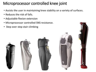 Microprocessor controlled knee joint
• Assists the user in maintaining knee stability on a variety of surfaces.
• Reduces the risk of falls.
• Adjustable flexion extension
• Microprocessor controlled SNS resistance.
• Step over step stair climbing
 