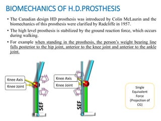 BIOMECHANICS OF H.D.PROSTHESIS
• The Canadian design HD prosthesis was introduced by Colin McLaurin and the
biomechanics of this prosthesis were clarified by Radcliffe in 1957.
• The high level prosthesis is stabilized by the ground reaction force, which occurs
during walking.
• For example when standing in the prosthesis, the person’s weight bearing line
falls posterior to the hip joint, anterior to the knee joint and anterior to the ankle
joint.
Knee Joint
Knee Axis
SEF
Knee Joint
Knee Axis SEF
Single
Equivalent
Force
(Projection of
CG)
 