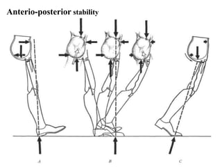 Anterio-posterior stability
 