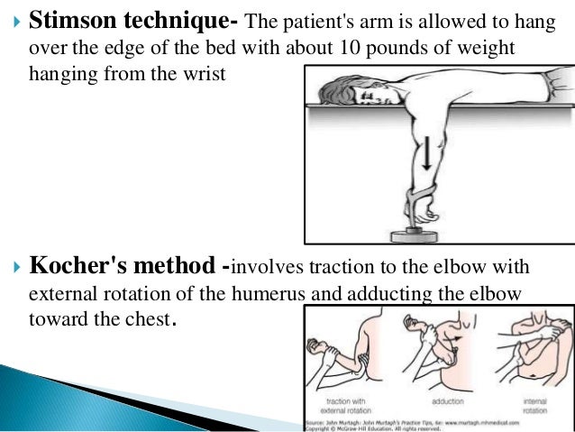 shoulder dislocation orthopedics + glenohumeral dislocation and man…