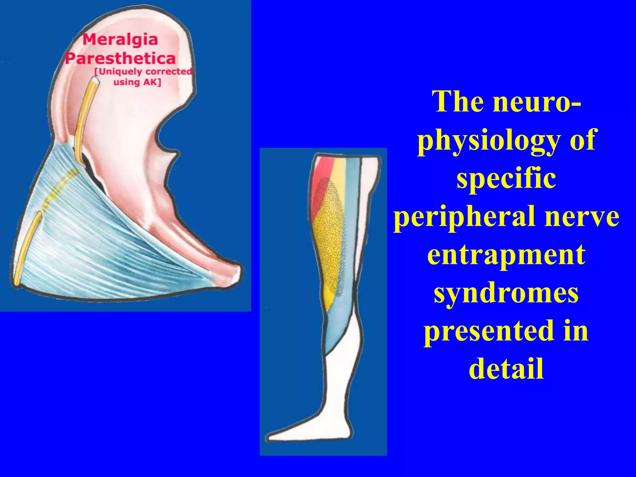 The neuro-
physiology of
specific
peripheral nerve
entrapment
syndromes
presented in
detail
 