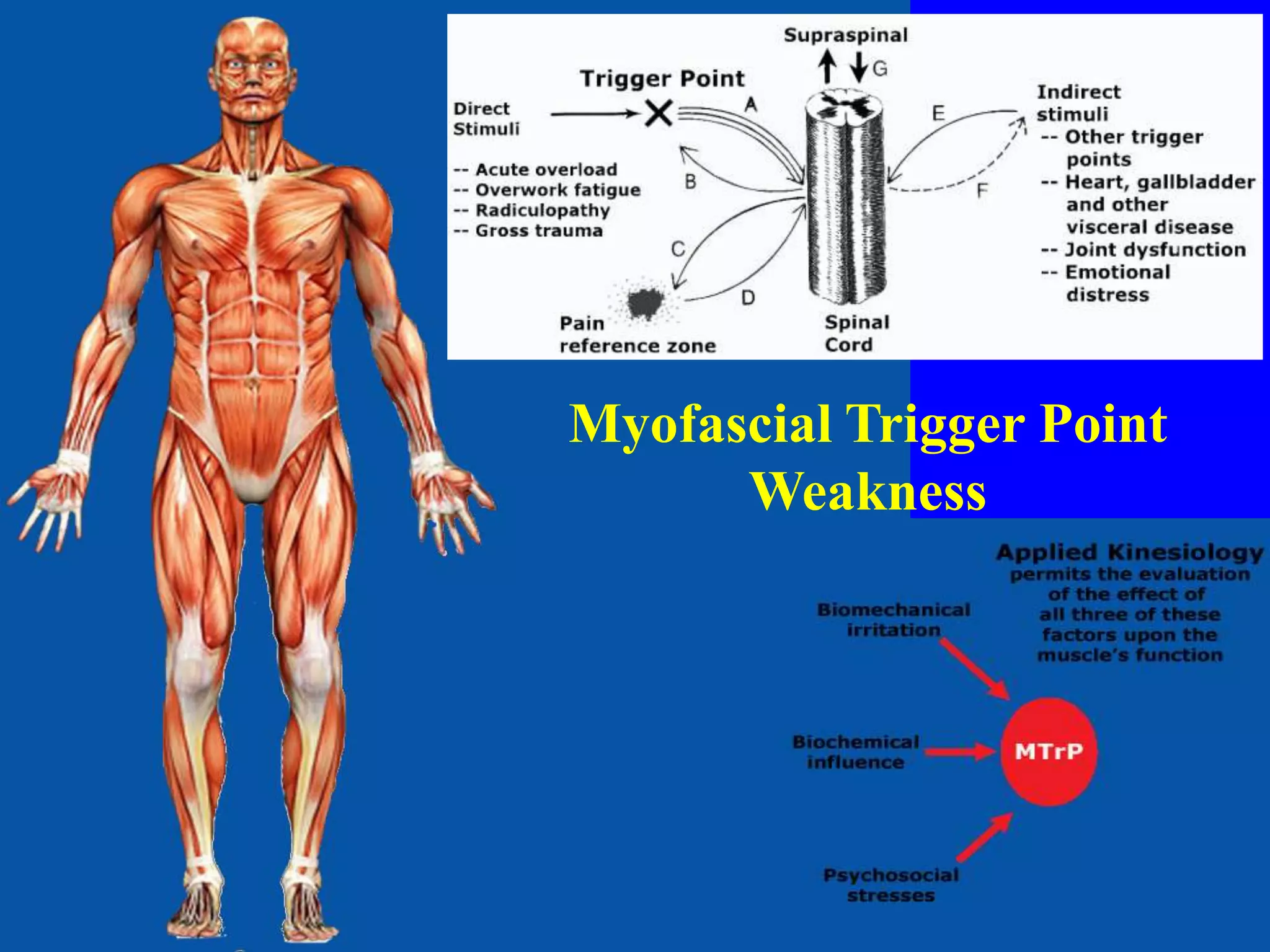 Myofascial Trigger Point
Weakness
 