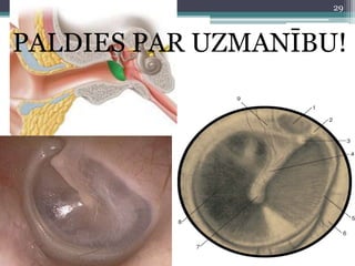 PALDIES PAR UZMANĪBU!
29
 