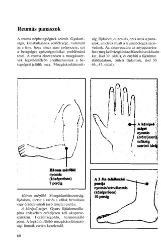 Reumás panaszok
A reuma népbetegségnek számít. Gyakori-
sága, kialakulásának sokfélesége, valamint
az a tény, hogy nincs igazi gyógyszere, ezt
a betegséget egészségpolitikai problémává
teszi. A reuma elnevezésen a mozgásszer-
vek legkülönfélébb elváltozásainak a be-
tegségeit jelölik meg. Mozgáskorlátozott-
Három mérföld. Mozgáskorlátozottság,
fájdalom, illetve a kar és a vállak bénulásos
vagy érzészavarrali járó tünetei esetén.
A középső sziget. Gyors fájdalomcsilla-
pítás érdekében erőteljesen kell akupresz-
szúrázni. Feszültségoldó, harmonizáló
pont. A legkülönfélébb mozgáskorlátozott-
sági fonnák esetén kezelendő.
60
ság, fájdalom, duzzadás, ezek azok a pana-
szok, amelyek miatt a reumabetegek szen-
vednek. Az akupresszúra az anyagcserére
hat (meg kell vizsgálni az étkezési szokásain-
kat, lásd 39. oldal), és enyhíti a fájdalmat.
(lábfájdalom, ízületi fájdalmak, lásd 50
46., 45. oldal).
 