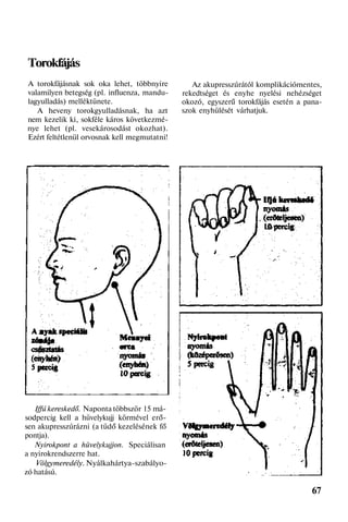 Torokfájás
A torokfájásnak sok oka lehet, többnyire
valamilyen betegség (pl. influenza, mandu-
lagyulladás) melléktünete.
A heveny torokgyulladásnak, ha azt
nem kezelik ki, sokféle káros következmé-
nye lehet (pl. vesekárosodást okozhat).
Ezért feltétlenül orvosnak kell megmutatni!
Iffú kereskedő. Naponta többször 15 má-
sodpercig kell a hüvelykujj körmével erő-
sen akupresszúrázni (a tüdő kezelésének fő
pontja).
Nyirokpont a hüvelykujjon. Speciálisan
a nyirokrendszerre hat.
Völgymeredély. Nyálkahártya-szabályo-
zó hatású.
Az akupresszúrától komplikációmentes,
rekedtséget és enyhe nyelési nehézséget
okozó, egyszerű torokfájás esetén a pana-
szok enyhülését várhatjuk.
67
 