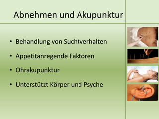 Abnehmen und Akupunktur

• Behandlung von Suchtverhalten

• Appetitanregende Faktoren

• Ohrakupunktur

• Unterstützt Körper und Psyche
 