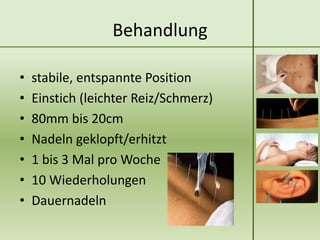 Behandlung

•   stabile, entspannte Position
•   Einstich (leichter Reiz/Schmerz)
•   80mm bis 20cm
•   Nadeln geklopft/erhitzt
•   1 bis 3 Mal pro Woche
•   10 Wiederholungen
•   Dauernadeln
 