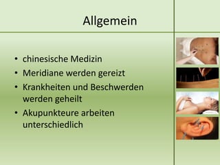Allgemein

• chinesische Medizin
• Meridiane werden gereizt
• Krankheiten und Beschwerden
  werden geheilt
• Akupunkteure arbeiten
  unterschiedlich
 