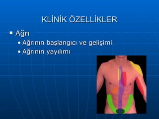 KLİNİK ÖZELLİKLER
   Ağrı
    • Ağrının   başlangıcı ve gelişimi
    • Ağrının   yayılımı
 