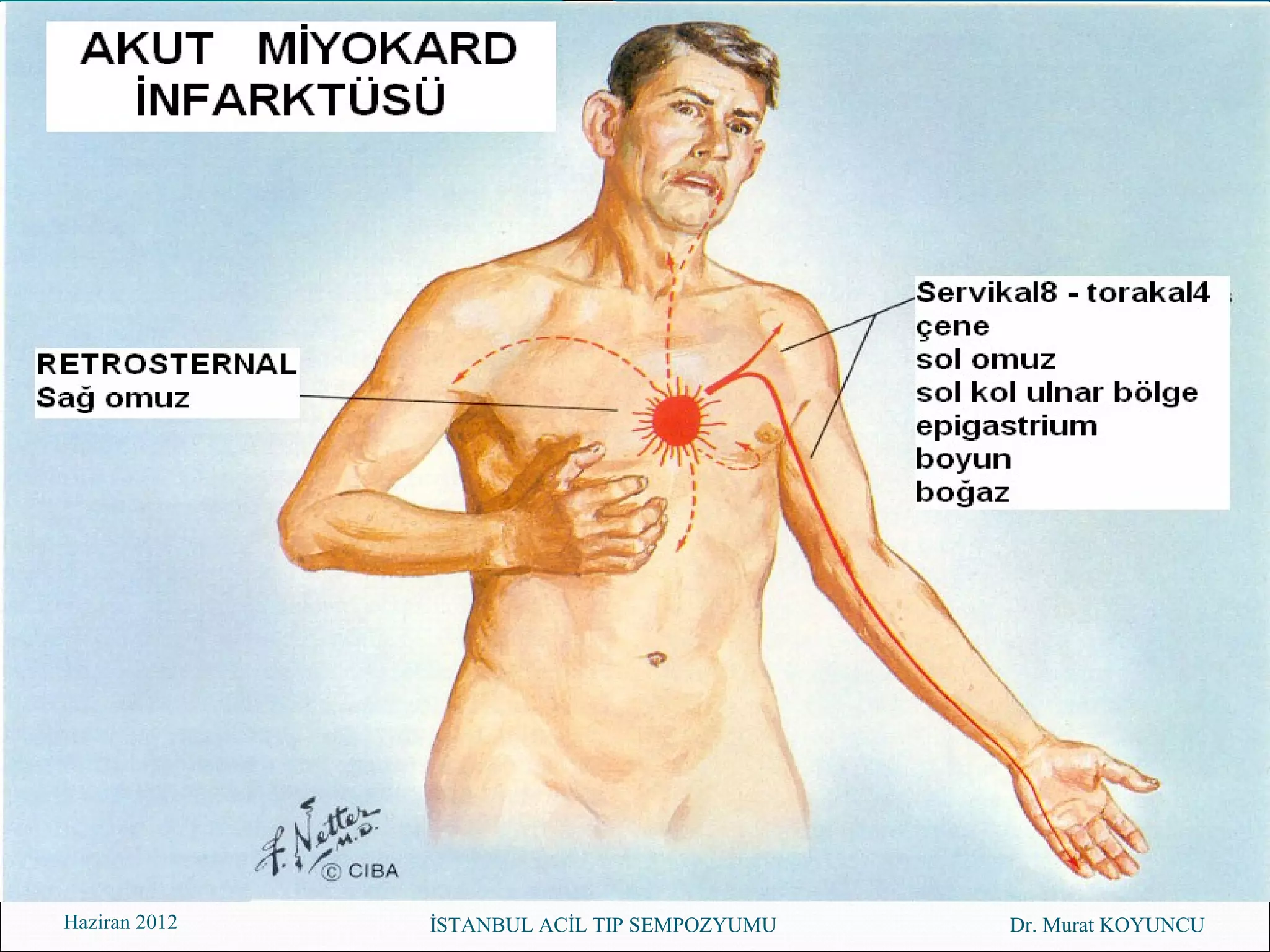 Haziran 2012   İSTANBUL ACİL TIP SEMPOZYUMU   Dr. Murat KOYUNCU
 