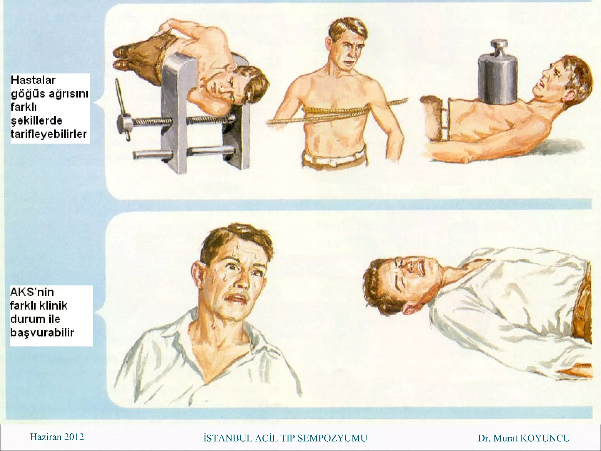 Haziran 2012   İSTANBUL ACİL TIP SEMPOZYUMU   Dr. Murat KOYUNCU
 