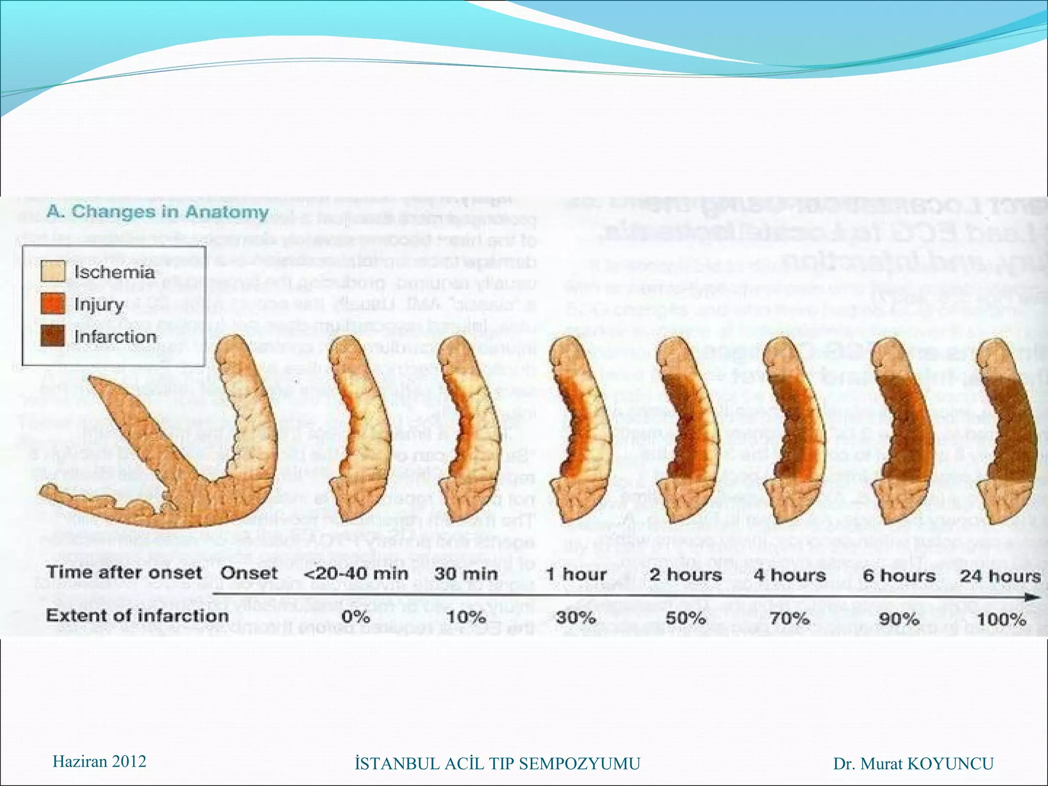 Haziran 2012   İSTANBUL ACİL TIP SEMPOZYUMU   Dr. Murat KOYUNCU
 