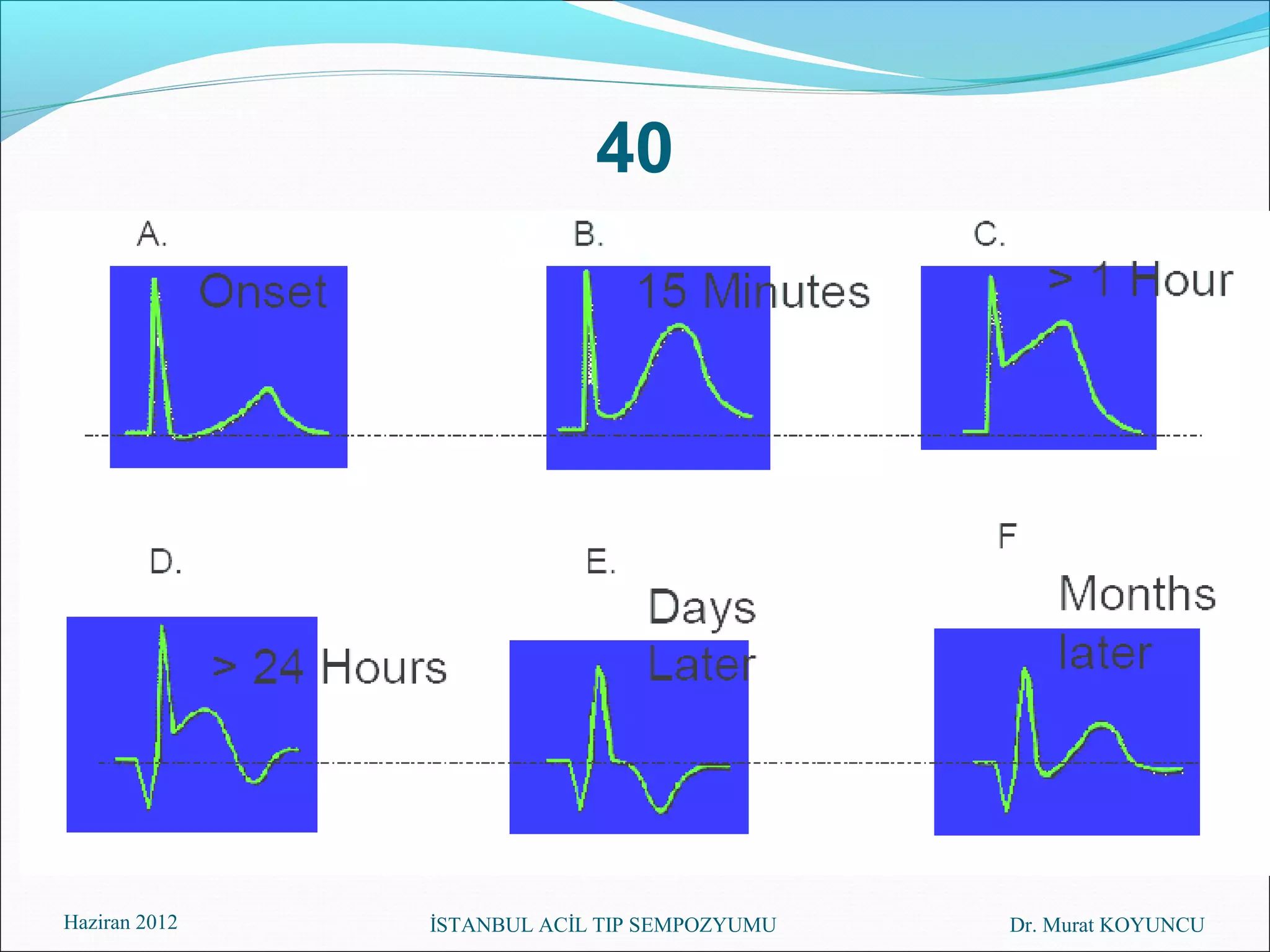 40




Haziran 2012   İSTANBUL ACİL TIP SEMPOZYUMU   Dr. Murat KOYUNCU
 