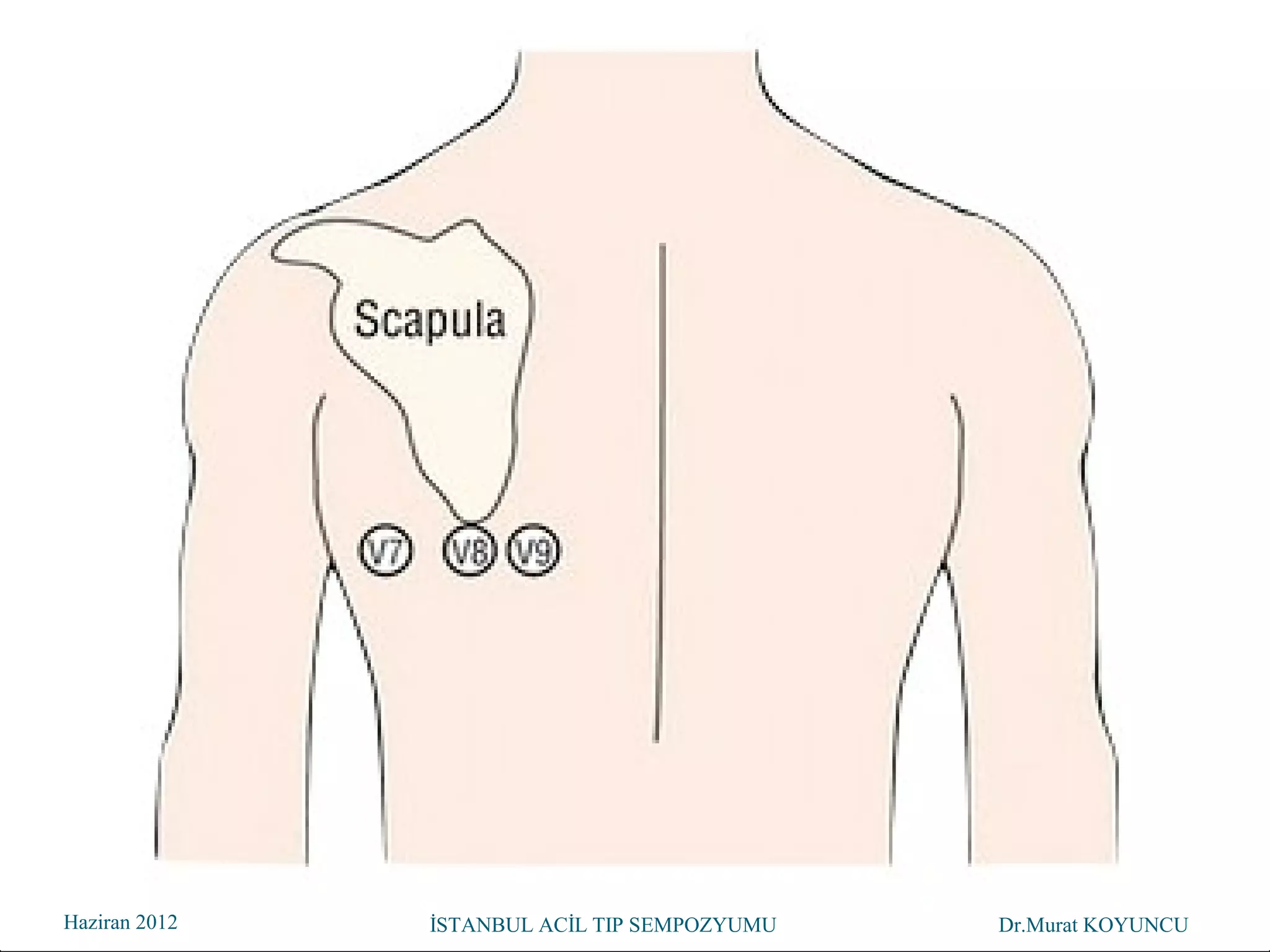 Haziran 2012   İSTANBUL ACİL TIP SEMPOZYUMU   Dr.Murat KOYUNCU
                                               Dr. Murat KOYUNCU
 