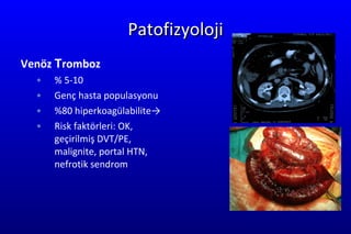 Patofizyoloji Ven öz   T romboz %   5-10 Genç hasta populasyonu %80   h i per k oag ülabilite-> Risk fa k t örleri :  OK ,  geçirilmiş  DVT/PE, mali gnite , portal HTN,  nefrotik sendrom 