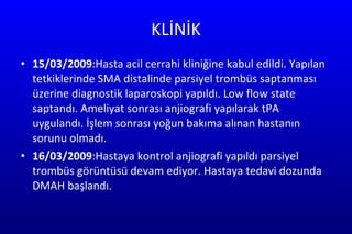 KLİNİK 15/03/2009 :Hasta acil cerrahi kliniğine kabul edildi. Yapılan tetkiklerinde SMA distalinde parsiyel trombüs saptanması üzerine diagnostik laparoskopi yapıldı. Low flow state saptandı. Ameliyat sonrası anjiografi yapılarak tPA  uygulandı. İşlem sonrası yoğun bakıma alınan hastanın sorunu olmadı. 16/03/2009 :Hastaya kontrol anjiografi yapıldı parsiyel trombüs görüntüsü devam ediyor. Hastaya tedavi dozunda DMAH başlandı. 
