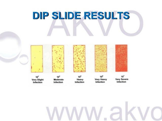 Akvo - the control of legionella bacteria in bakery water systems