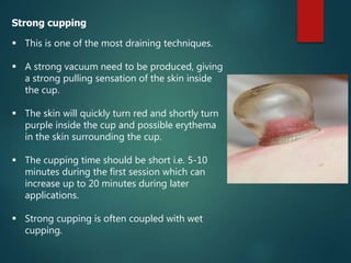 Strong cupping
 This is one of the most draining techniques.
 A strong vacuum need to be produced, giving
a strong pulling sensation of the skin inside
the cup.
 The skin will quickly turn red and shortly turn
purple inside the cup and possible erythema
in the skin surrounding the cup.
 The cupping time should be short i.e. 5-10
minutes during the first session which can
increase up to 20 minutes during later
applications.
 Strong cupping is often coupled with wet
cupping.
 