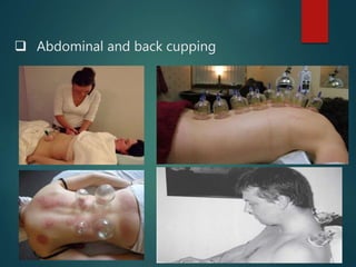  Abdominal and back cupping
 