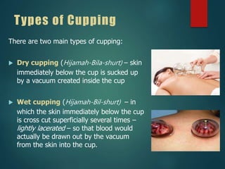 Types of Cupping
There are two main types of cupping:
 Dry cupping (Hijamah-Bila-shurt) – skin
immediately below the cup is sucked up
by a vacuum created inside the cup
 Wet cupping (Hijamah-Bil-shurt) – in
which the skin immediately below the cup
is cross cut superficially several times –
lightly lacerated – so that blood would
actually be drawn out by the vacuum
from the skin into the cup.
 