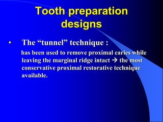 Tooth preparation
designs
• The “tunnel” technique :
has been used to remove proximal caries while
leaving the marginal ri...