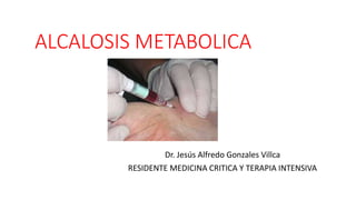 ALCALOSIS METABOLICA
Dr. Jesús Alfredo Gonzales Villca
RESIDENTE MEDICINA CRITICA Y TERAPIA INTENSIVA
 