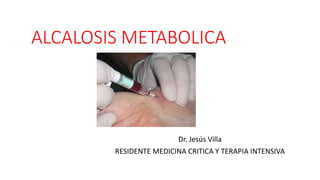 ALCALOSIS METABOLICA
Dr. Jesús Villa
RESIDENTE MEDICINA CRITICA Y TERAPIA INTENSIVA
 