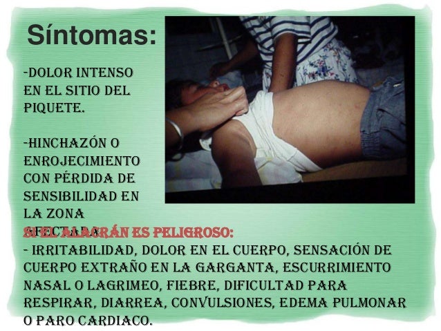 Picadura de Alacrán Picadura de Alacrán