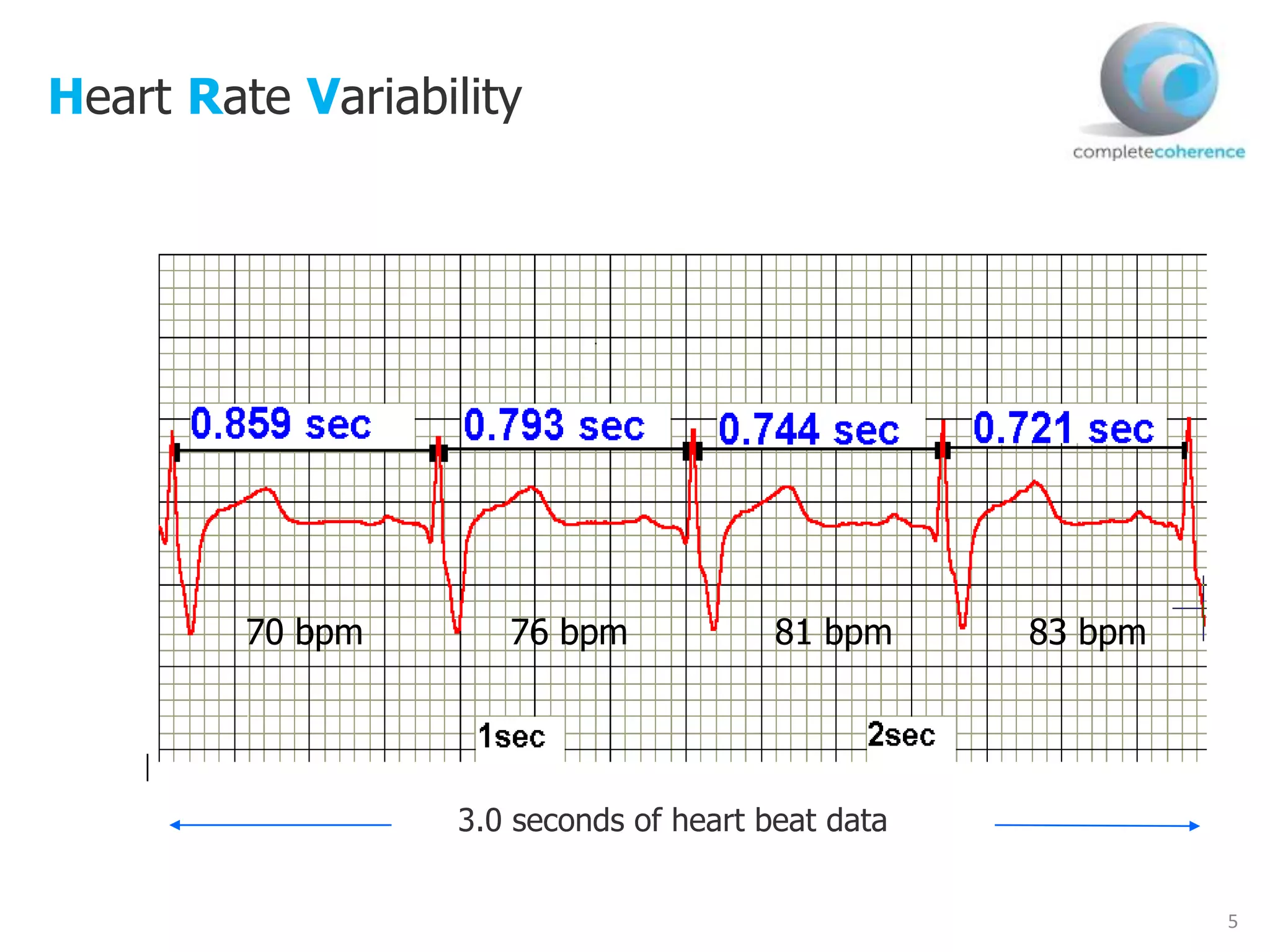 5
Heart Rate Variability
3.0 seconds of heart beat data
70 bpm 83 bpm81 bpm76 bpm
 
