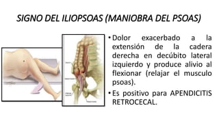 Signo Del Psoas