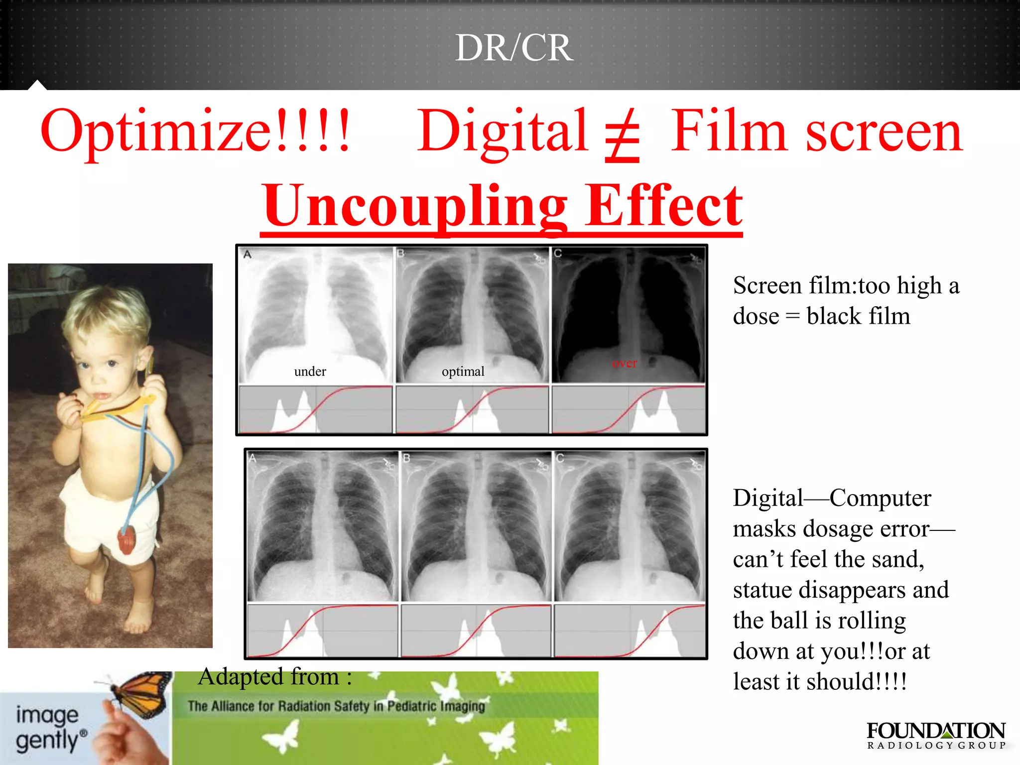 DR/CR

Optimize!!!! Digital ≠ Film screen
        Uncoupling Effect
                                       Screen film:too high a
                                       dose = black film
                                over
             under    optimal




                                       Digital—Computer
                                       masks dosage error—
                                       can’t feel the sand,
                                       statue disappears and
                                       the ball is rolling
                                       down at you!!!or at
     Adapted from :                    least it should!!!!
 