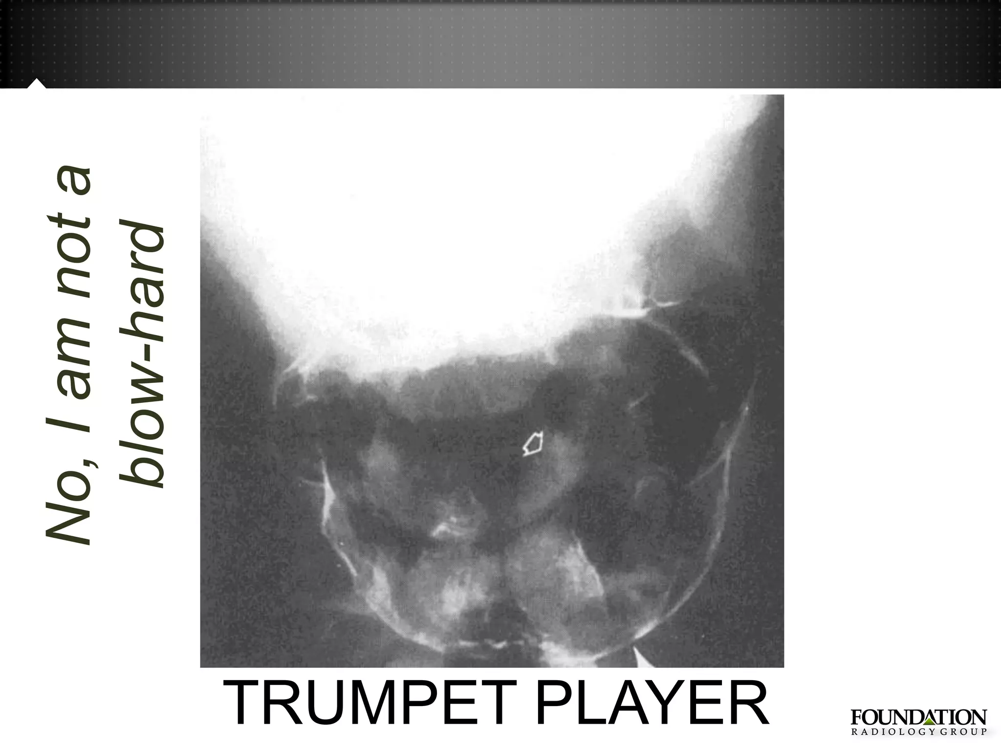 No, I am not a
                  blow-hard




TRUMPET PLAYER
 