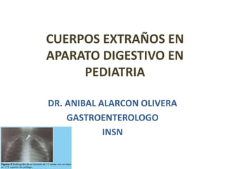CUERPOS EXTRAÑOS EN
APARATO DIGESTIVO EN
PEDIATRIA
DR. ANIBAL ALARCON OLIVERA
GASTROENTEROLOGO
INSN
 