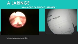 A LARINGE
Profa.dra.ana paula zarzur 2024
AVALIAÇÃO DA FUNÇÃO LARINGEA
 