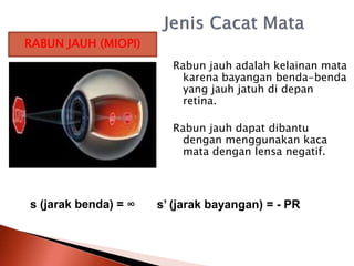 Rabun jauh adalah kelainan mata
karena bayangan benda-benda
yang jauh jatuh di depan
retina.
Rabun jauh dapat dibantu
dengan menggunakan kaca
mata dengan lensa negatif.
s (jarak benda) = ∞ s’ (jarak bayangan) = - PR
RABUN JAUH (MIOPI)
 