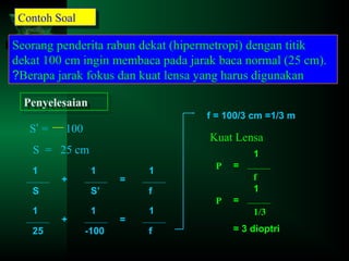 Contoh Soal
Contoh Soal

Seorang penderita rabun dekat (hipermetropi) dengan titik
dekat 100 cm ingin membaca pada jarak baca normal (25 cm).
?Berapa jarak fokus dan kuat lensa yang harus digunakan
Penyelesaian
Penyelesaian
S’ =

f = 100/3 cm =1/3 m

100

Kuat Lensa

S = 25 cm
1

+

1
1

=

1

S

S’

f

1

1

1

25

+

-100

=

f

P

=
f
1

P

=
1/3
= 3 dioptri

 