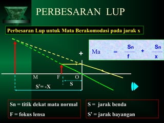 PERBESARAN LUP
Perbesaran Lup untuk Mata Berakomodasi pada jarak x

+
M
S’= -X

F

Ma

=

Sn
f

O
S

Sn = titik dekat mata normal

S = jarak benda

F = fokus lensa

S’ = jarak bayangan

+

Sn
x

 