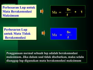 Perbesaran Lup untuk
Mata Berakomodasi
Maksimum

Perbesaran Lup
Perbesaran Lup
untuk Mata Tidak
untuk Mata Tidak
Berakomodasi
Berakomodasi

Ma =

Ma =

Sn
f

+

1

Sn
f

Penggunaan normal sebuah lup adalah berakomodasi
maksimum. Jika dalam soal tidak disebutkan, maka selalu
dianggap lup digunakan mata berakomodasi maksimum

 