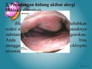Alat indera | PPTX
