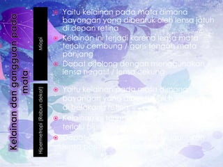 MiopiHipermetropi(Rabundekat)
 Yaitu kelainan pada mata dimana
bayangan yang dibentuk oleh lensa jatuh
di depan retina
 Kelainan ini terjadi karena lensa mata
terlalu cembung / garis tengah mata
panjang
 Dapat ditolong dengan menggunakan
lensa negatif / lensa cekung
 Yaitu kelainan pada mata dimana
bayangan yang dibentuk oleh lensa jatuh
di belakang retina
 Kelainan ini terjadi karena lensa mata
terlalu pipih / garis tengah mata pendek
 Dapat ditolong dengan menggunakan
lensa positif / lensa cembung
 
