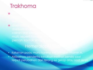 Trachoma adalah sebuah penyakit mata menular,
dan penyebab utama kebutaan akibat infeksi di
dunia.
 disebabkan oleh Chlamydia trachomatis dan
disebarkan melalui kontak langsung yang terkena
cairan dari pengidap, atau kontak dengan benda
mati, seperti handuk dan / atau kain lap, yang
pernah kontak serupa dengan cairan ini.
Hemeralopi / Rabun senja
• Kelainan pada mata karena kekurangan vitamin A.
• Akibatnya penderita kesulitan melihat benda saat
terjadi perubahan dari terang ke gelap atau saat senja
 