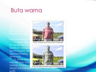 - Gangguan ini merupakan penyakit mata
yang bersifat menurun
- Mata normal mempunyai 3 macam sel
konus yang berkerja dengan baik, hal itu
disebut mata trikromal. Bila salah satu atau
lebih sel konus rusak maka menyebabkan
terjadinya buta warna
Macam-macam buta warna:
1. Mata dikromat bila hanya memiliki
2 macam sel konus yang normal. Dengan
demikian didapatkan buta warna merah
(prota nopia), buta warna hijau
(deuteranopia), dan buta warna biru
(tritanopi)
2. Mata monokromat yaitu bila
memiliki satu macam sel konus yang
normal. Orang yang demikian hanya
dapat membedakan warna hitam dan
putih
 