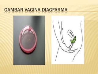 GAMBAR VAGINA DIAGFARMA
 