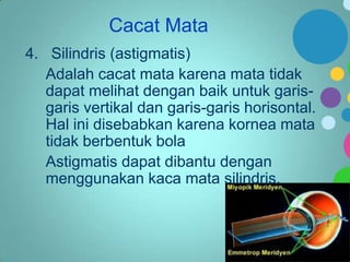 Cacat Mata
4. Silindris (astigmatis)
Adalah cacat mata karena mata tidak
dapat melihat dengan baik untuk garisgaris vertikal dan garis-garis horisontal.
Hal ini disebabkan karena kornea mata
tidak berbentuk bola
Astigmatis dapat dibantu dengan
menggunakan kaca mata silindris.

 