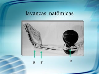 Alavancas Anatômicas




                  R
   E   F
 