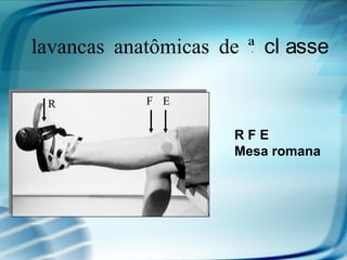Alavancas anatômicas de 3ª cl asse

 R           F E

                       RFE
                       Mesa romana
 