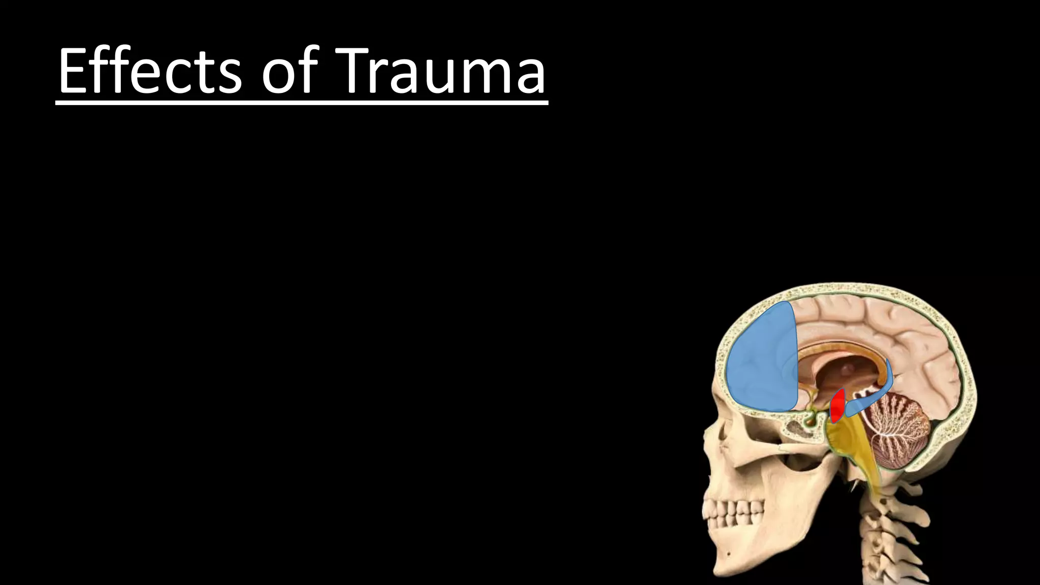 Effects of Trauma
 